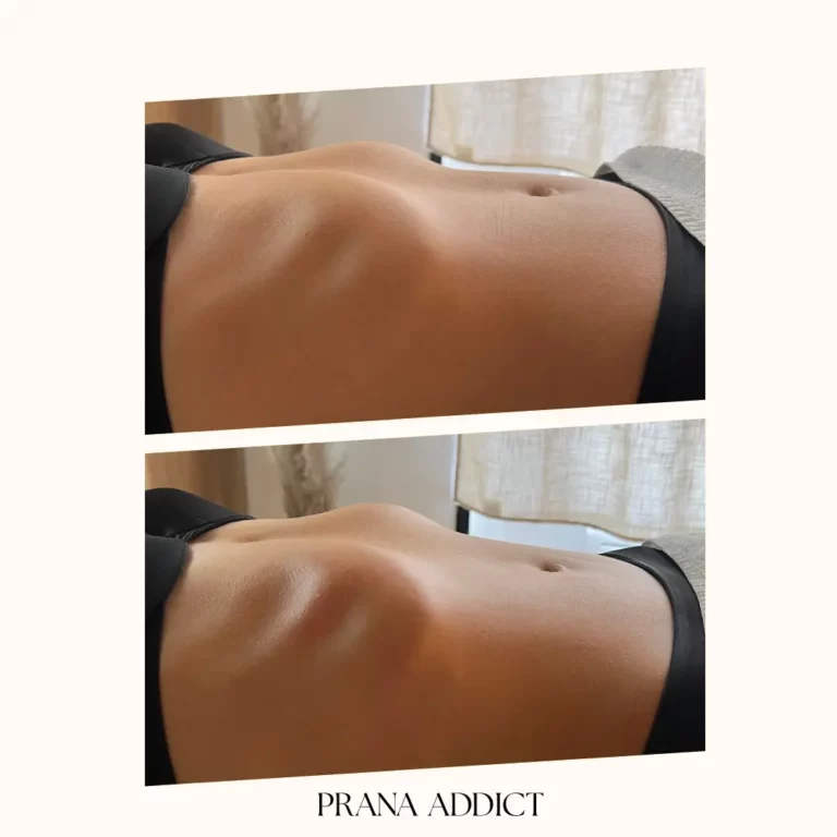 drainage lymphatique - avant et apres - 1