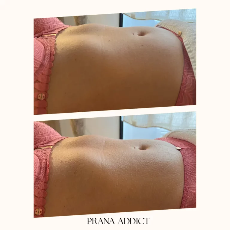 drainage lymphatique - avant et apres - 2