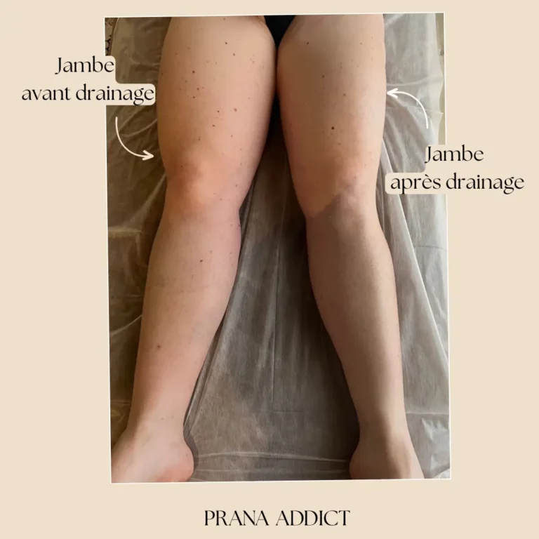 drainage lymphatique - avant et apres - 3