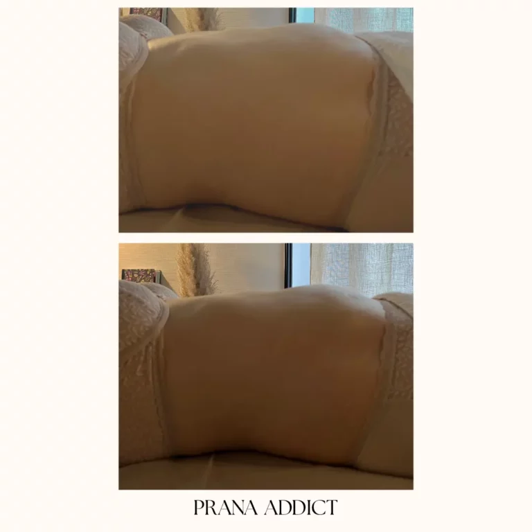 drainage lymphatique - avant et apres - 4