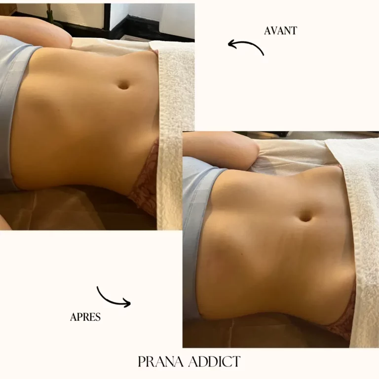 drainage lymphatique - avant et apres - 5