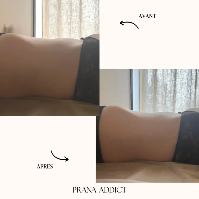 drainage lymphatique - avant et apres - 6