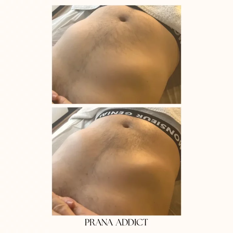 drainage lymphatique - avant et apres - 7