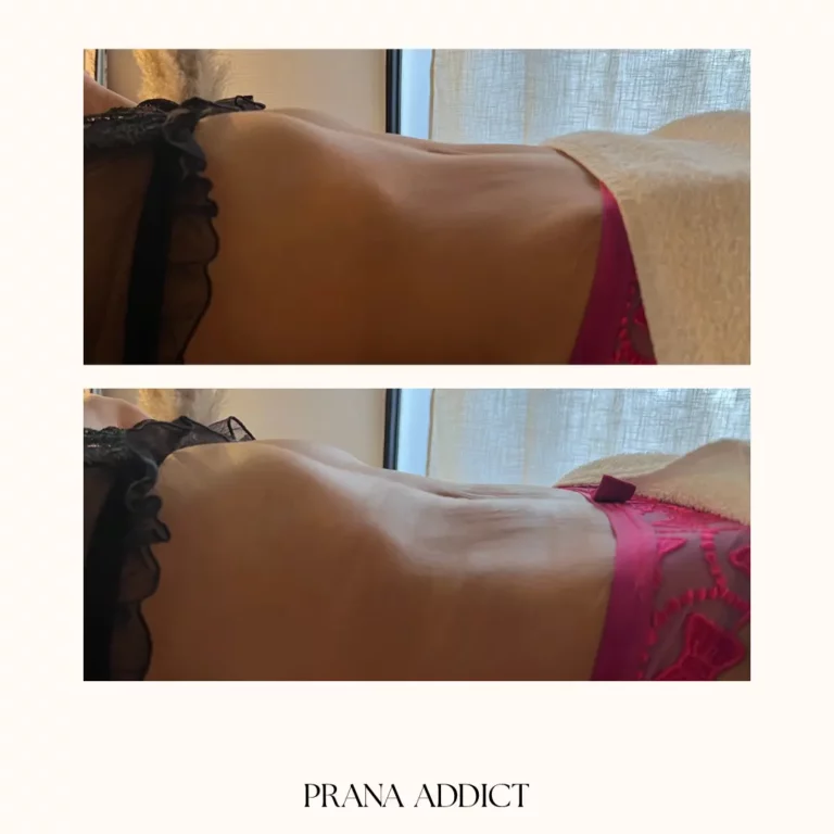 drainage lymphatique - avant et apres - 8