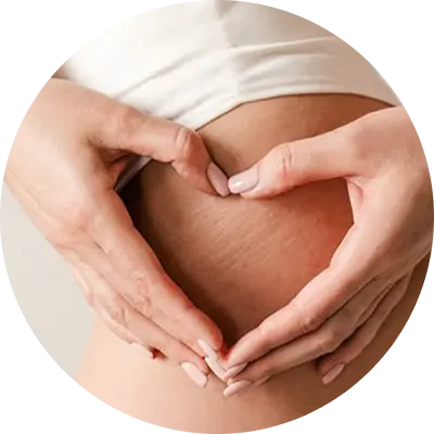 cellulite 1